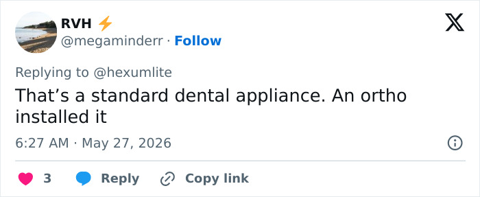 Comment explains maxilla expander as standard dental appliance Comment explains maxilla expander as standard dental appliance