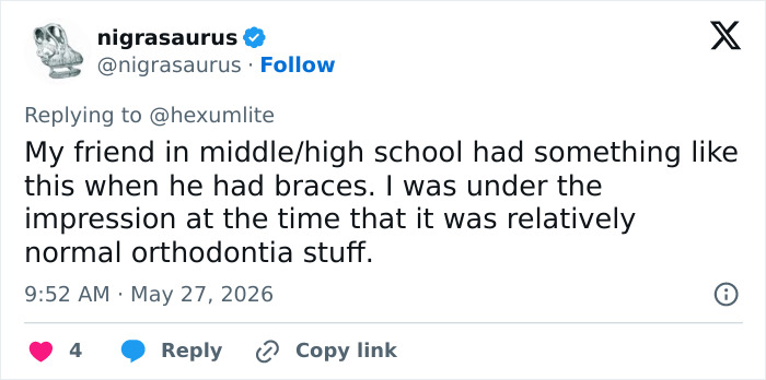 User recalls friend using maxilla expander with braces User recalls friend using maxilla expander with braces