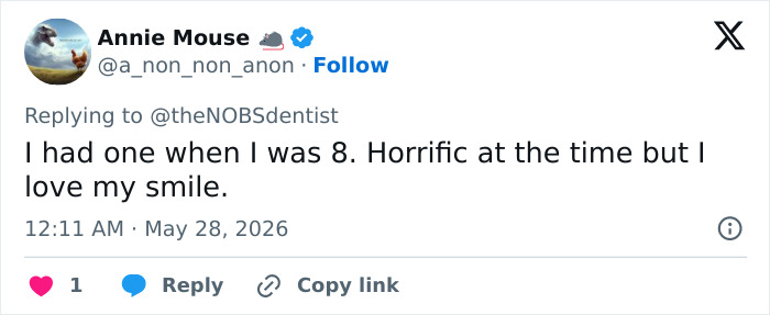Twitter user shares experience of having a maxilla expander at age 8 and loving smile Twitter user shares experience of having a maxilla expander at age 8 and loving smile