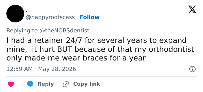 Twitter user describes wearing a retainer to expand teeth and avoid braces Twitter user describes wearing a retainer to expand teeth and avoid braces