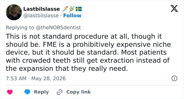 Explanation of maxilla expander as costly but needed dental device Explanation of maxilla expander as costly but needed dental device