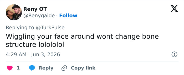 Tweet arguing daily jaw exercises won't change bone structure