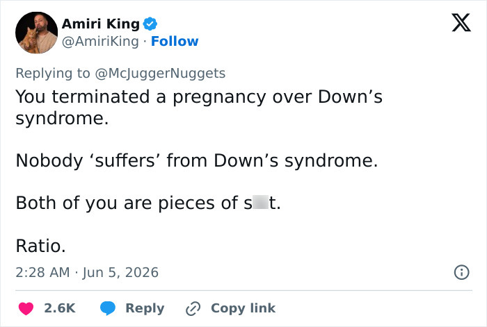 YouTuber's Response To Outrage Backfires After He And Wife Terminated Pregnancy Because Baby Had Down Syndrome