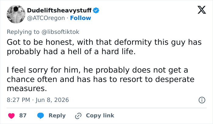 Tweet expressing sympathy for Baton Rouge influencer with deformity Tweet expressing sympathy for Baton Rouge influencer with deformity