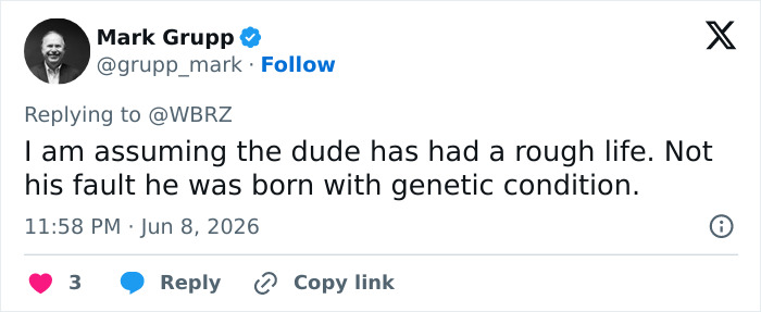 Social media comment on influencer from Baton Rouge with genetic condition Social media comment on influencer from Baton Rouge with genetic condition