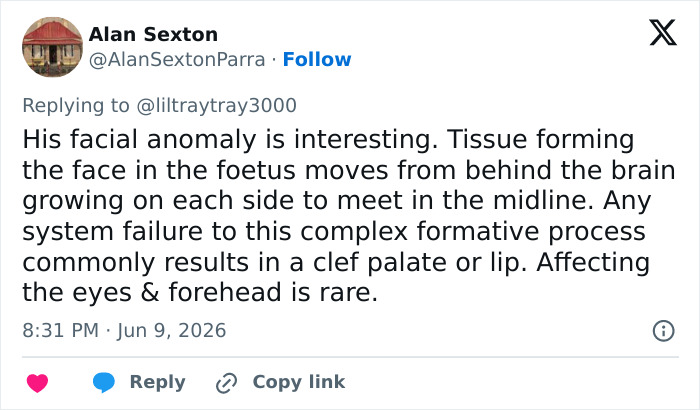 Tweet explaining facial anomaly related to Baton Rouge influencer break-in Tweet explaining facial anomaly related to Baton Rouge influencer break-in