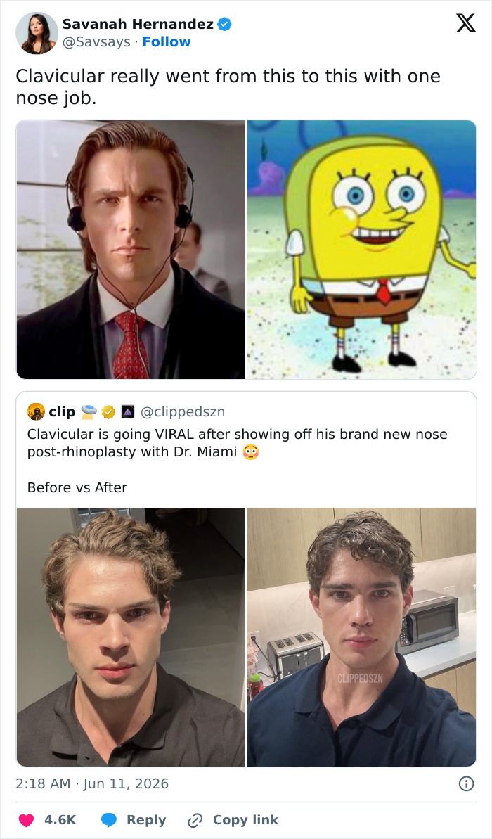 Social media post showing before and after rhinoplasty looksmaxxing results Social media post showing before and after rhinoplasty looksmaxxing results