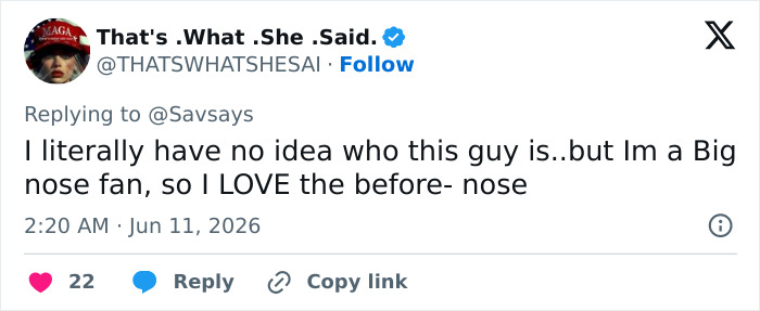 User praises clavicular's nose before looksmaxxing on social media User praises clavicular's nose before looksmaxxing on social media