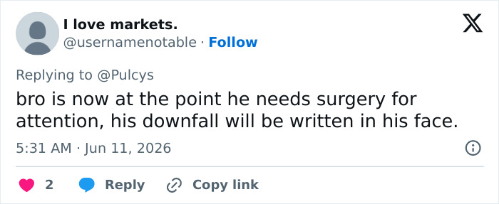 Comment on looksmaxxing needing surgery with downfall in his face Comment on looksmaxxing needing surgery with downfall in his face