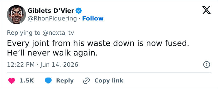 Man standing for over 5 years in extreme act of devotion, comment about physical state. Man standing for over 5 years in extreme act of devotion, comment about physical state.