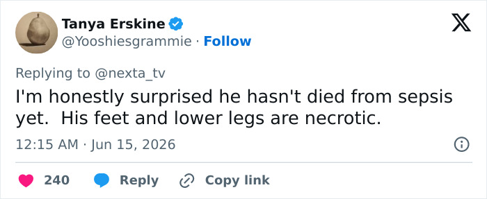 A tweet by Tanya Erskine about a man standing for 5 years, concerned about necrosis and sepsis. A tweet by Tanya Erskine about a man standing for 5 years, concerned about necrosis and sepsis.