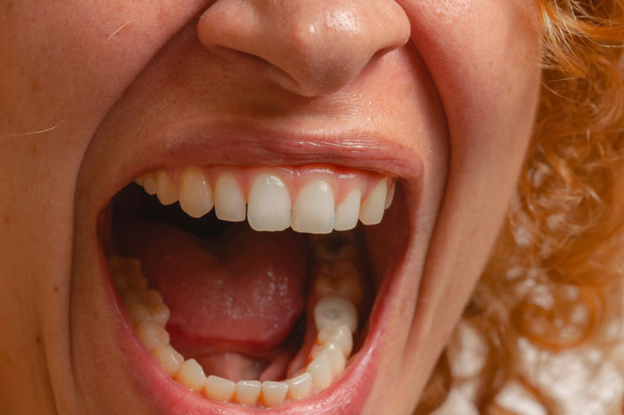 Close-up of a person shouting with mouth wide open Close-up of a person shouting with mouth wide open