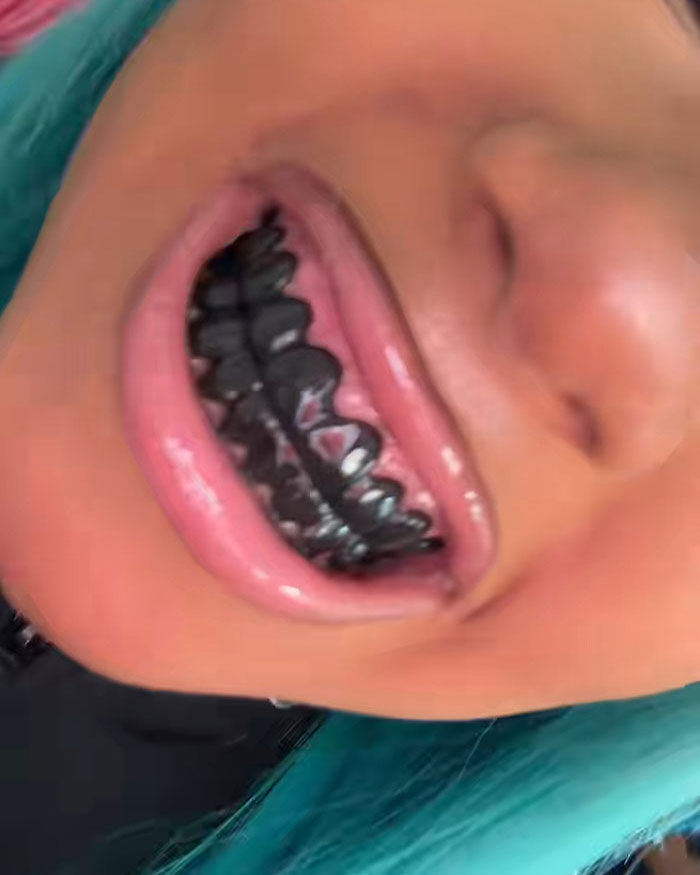 Closeup of person wearing black grills on teeth with turquoise hair Closeup of person wearing black grills on teeth with turquoise hair