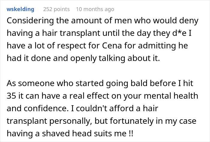 Screenshot of a comment praising John Cena for admitting his hair transplant and discussing its impact.
