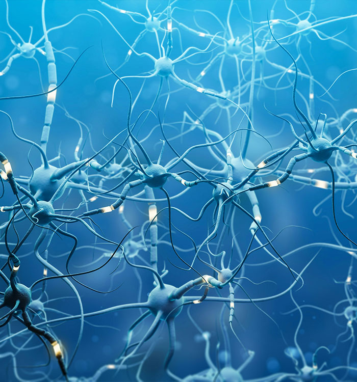 Illustration of neurons affected by silent brain-sapper in postmenopausal women Illustration of neurons affected by silent brain-sapper in postmenopausal women