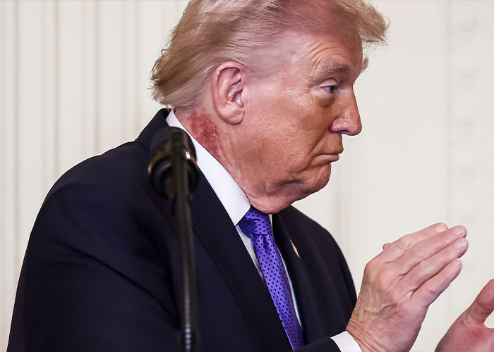 Profile of Trump speaking with focus on his health condition Profile of Trump speaking with focus on his health condition
