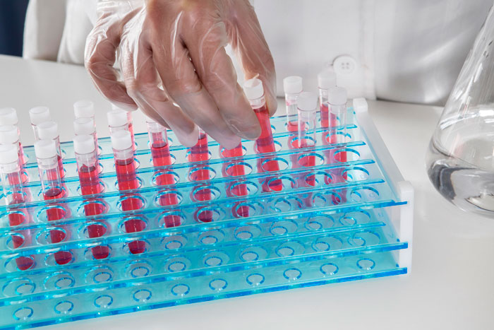A gloved hand placing a test tube in a rack, illustrating the scientific aspect of DNA testing stories.