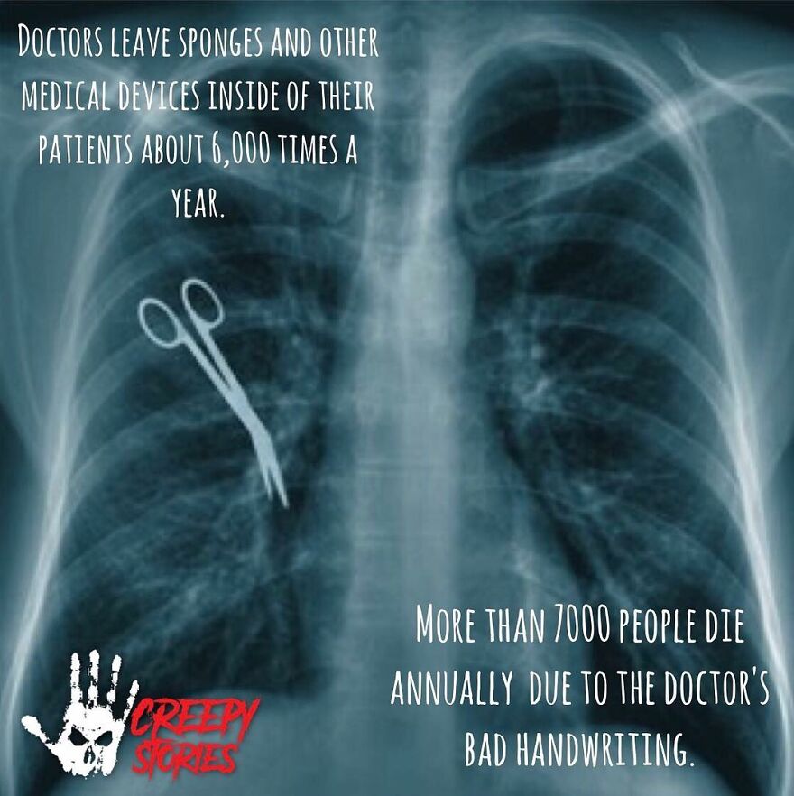An X-ray showing scissors inside a patient, a terrifying fact about medical errors.