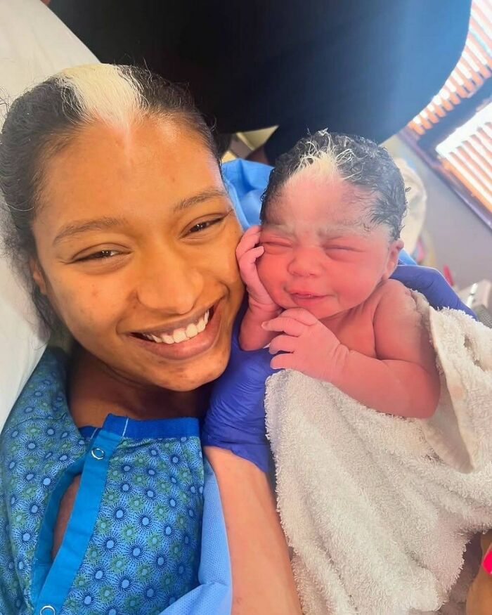 Mother And Newborn Share A Rare Hair Trait That Stunned The Internet