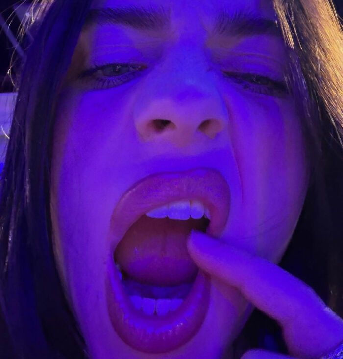 Doctor Steps In After Billie Eilish Gets Accused Of Pretending To Have Neurological Disorder