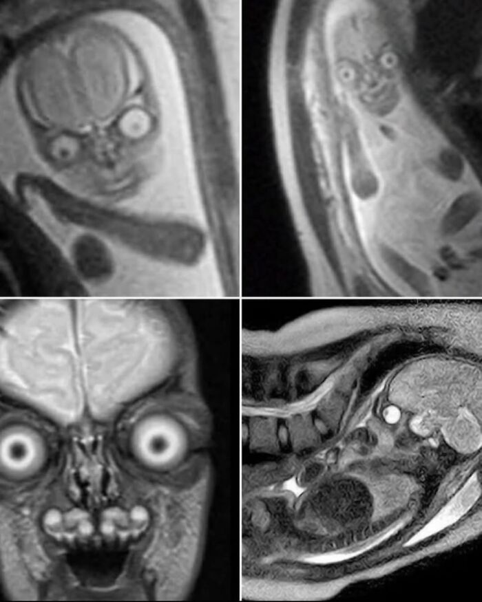The Reason Pregnant Women Get Ultrasounds Instead Of Mris