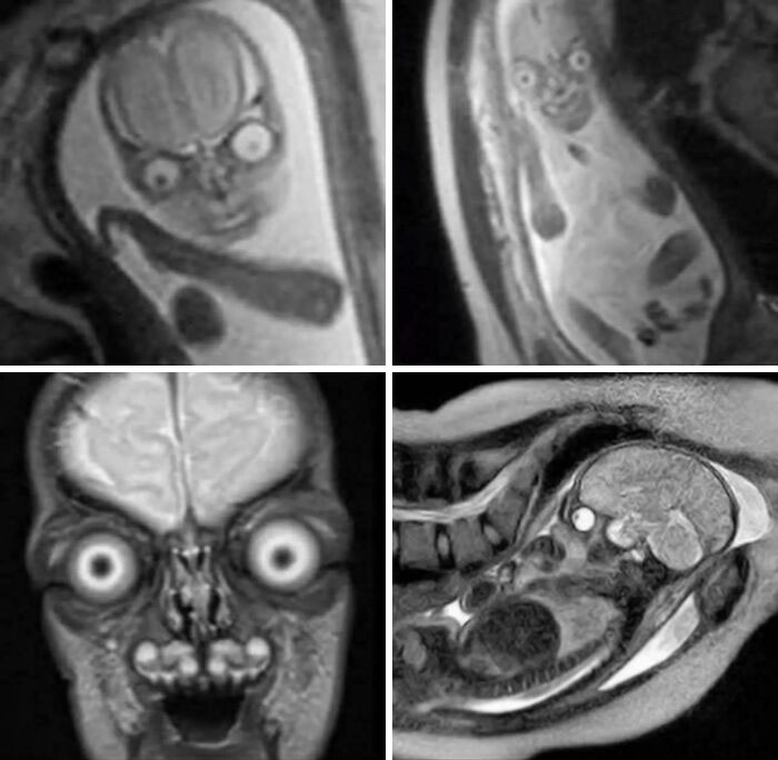 MRI scans showing unusual and eerie facial expressions resembling a creepy doll