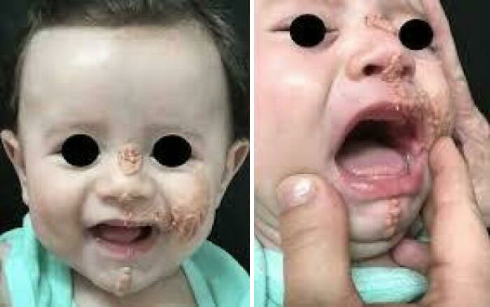 Creepy baby with blacked-out eyes and unusual facial growths