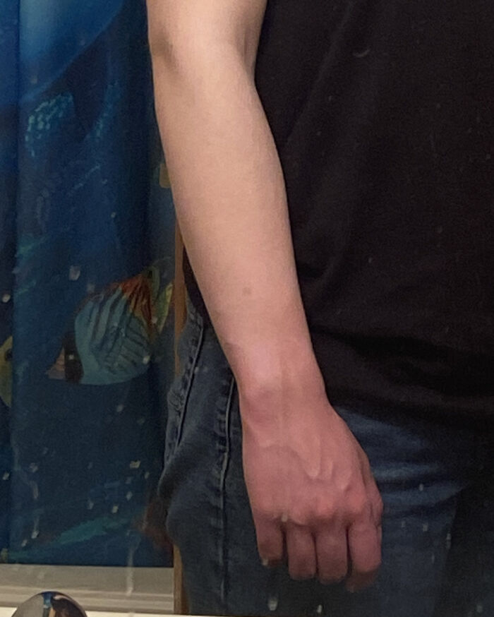 Human arm showing visible vein quirks on forearm and hand