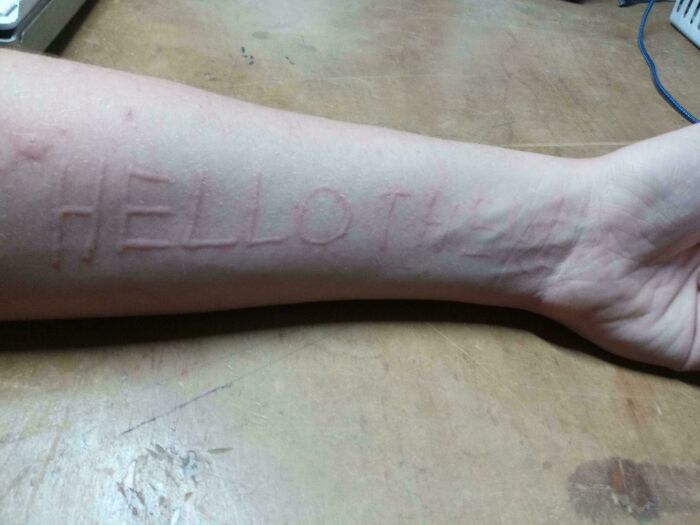 Forearm with raised letters forming a word visible as a unique human body quirk