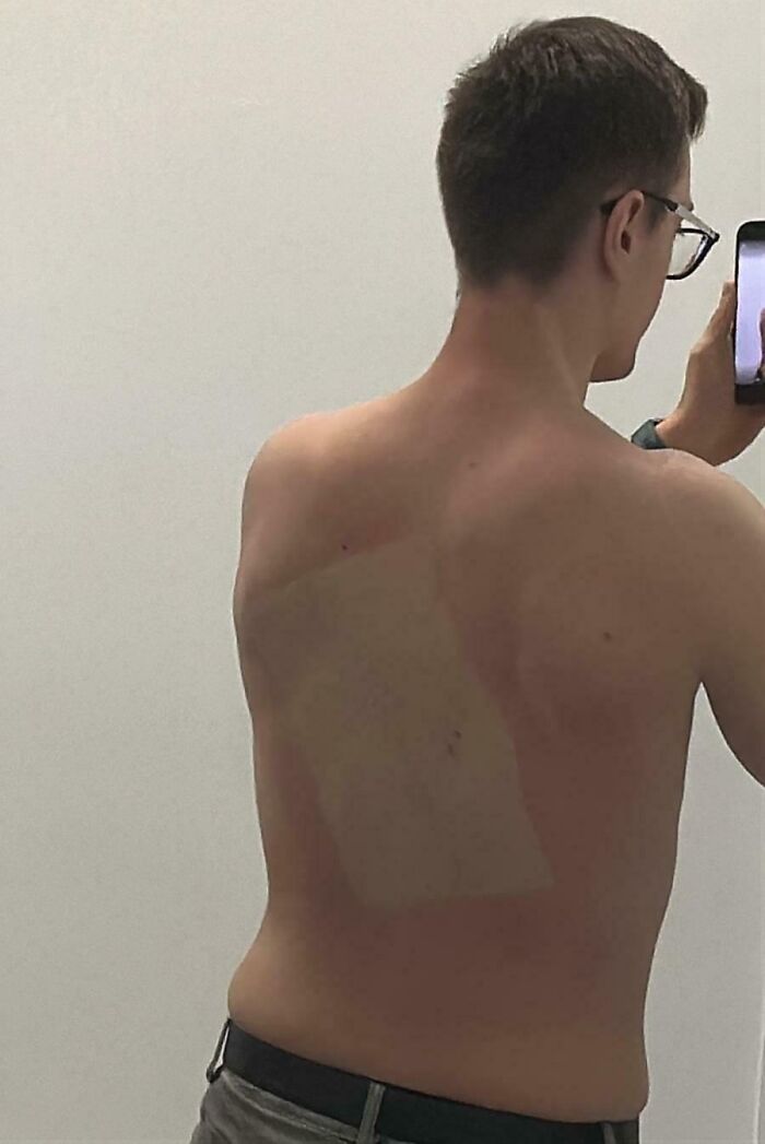 Thought I’d Try A Tanning Booth For The First Time. Did Not Notice The Cardboard That I Laid On