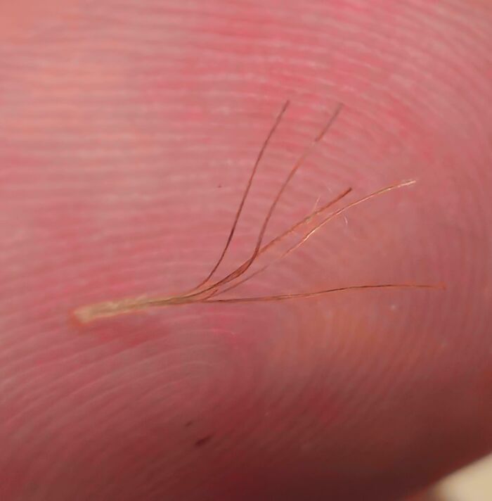 Macro image of multiple fine hairs growing from a single pore on human skin