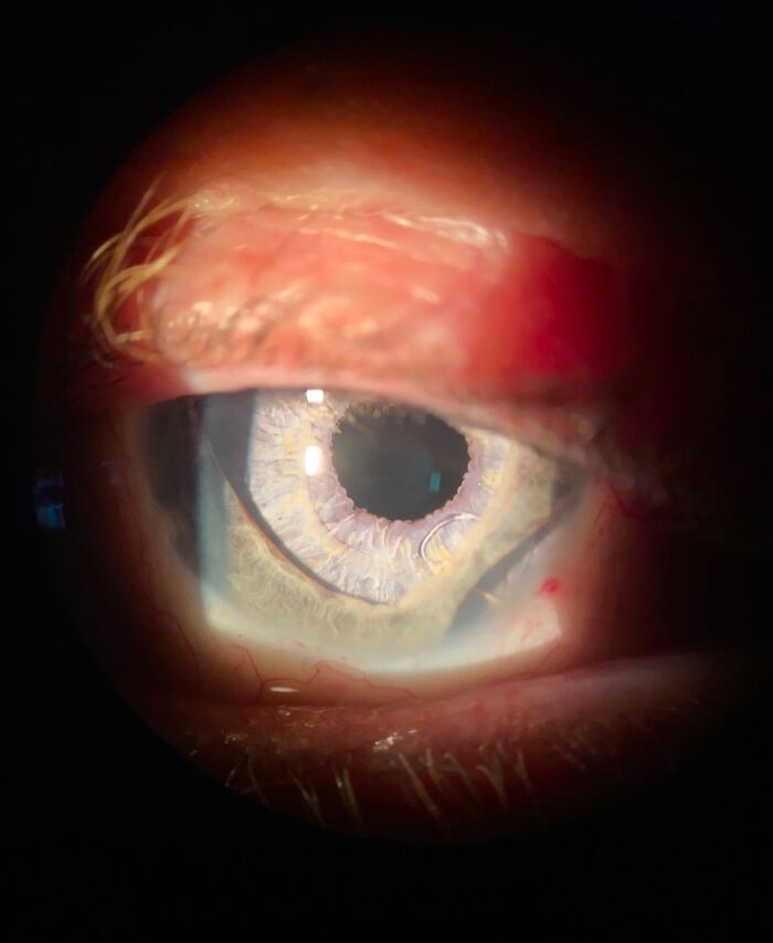 Close-up photo of a human eye showing a unique iris pattern and eye details