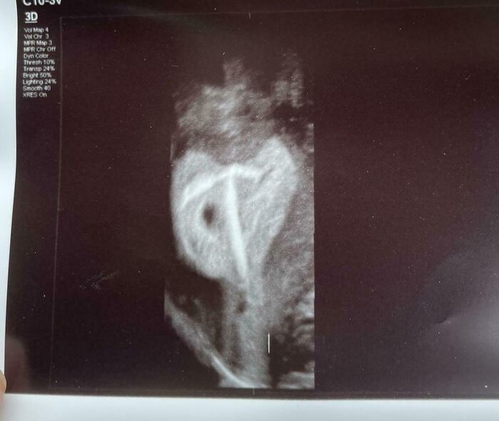3D ultrasound scan displaying internal body quirks