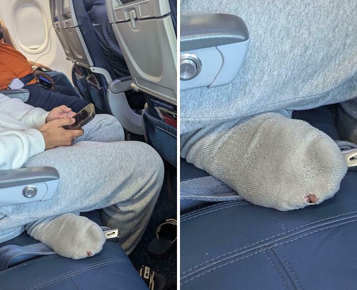 Airports scene: a passenger with an exposed toe poking out of a makeshift sock, showcasing chaotic travel moments.