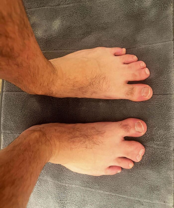Unusual human body quirks featuring feet with an extra toe on each