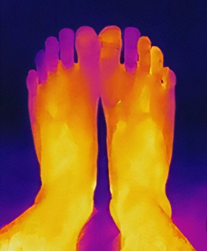 Thermal image of feet showing temperature variations with toes highlighted