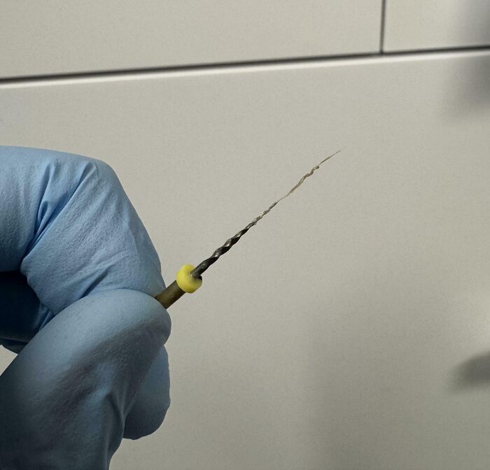 Close-up of a twisted dental root canal file held by a gloved hand showing human body quirks