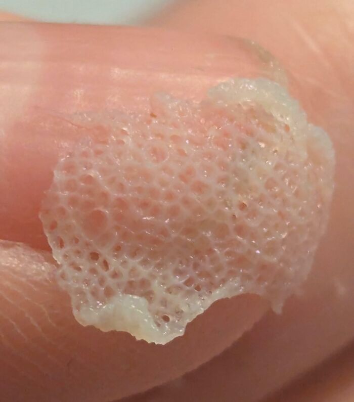 Close-up of textured skin flake or peeling showing body quirks