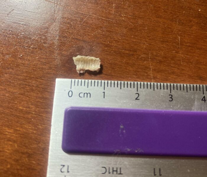 Small skin flake measured next to ruler showcasing human body quirks