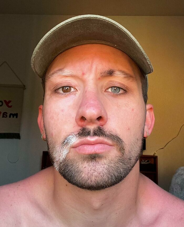 Man with heterochromia and half white beard showing body quirks