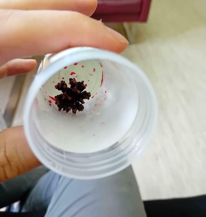 Blood clot inside a plastic cup showing human body quirks