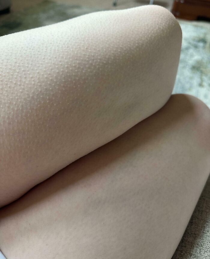 Comparison of legs showing noticeable goosebumps quirk on human skin
