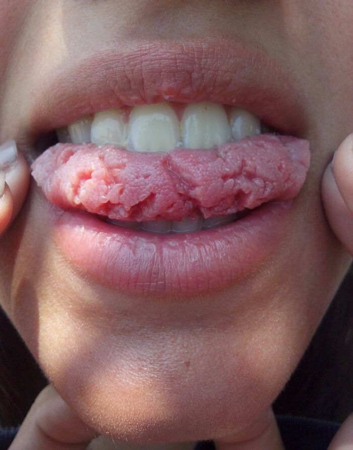 Close-up of human body quirk with textured, swollen lower lip