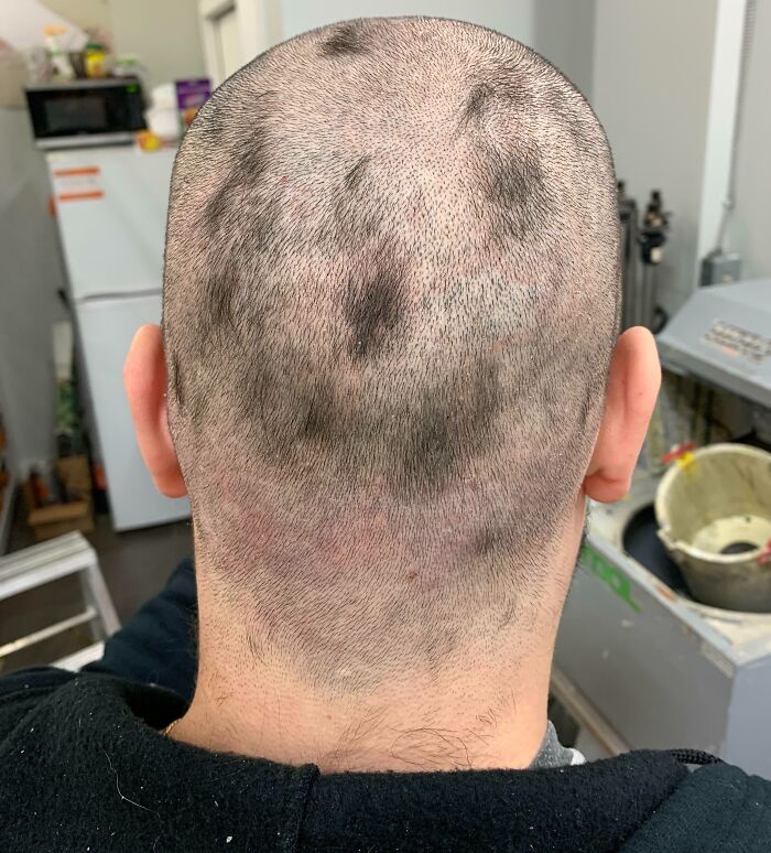 My First Attempt At “Shaving” My Head. Been At Work For Two Days Like This And Didn’t Even Realize Until A Coworker Asked, “Are You Okay?”