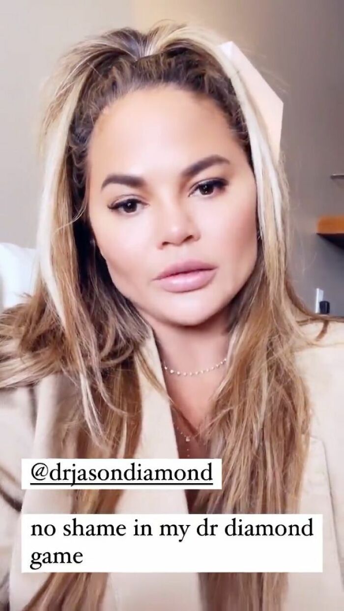 Woman discussing plastic surgery trends and regrets with Dr Diamond