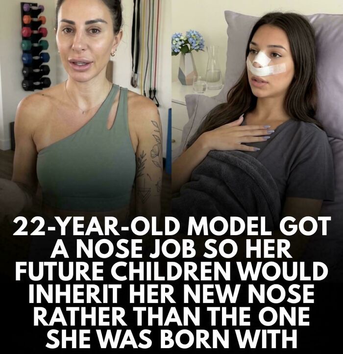 A 22-year-old model with a bandaged nose after a nose job, an unpredictable sentence about inheriting features.