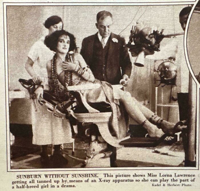 Lorna Lawrence gets tanned by a dangerous X-ray apparatus, one of the dangerous things people did.