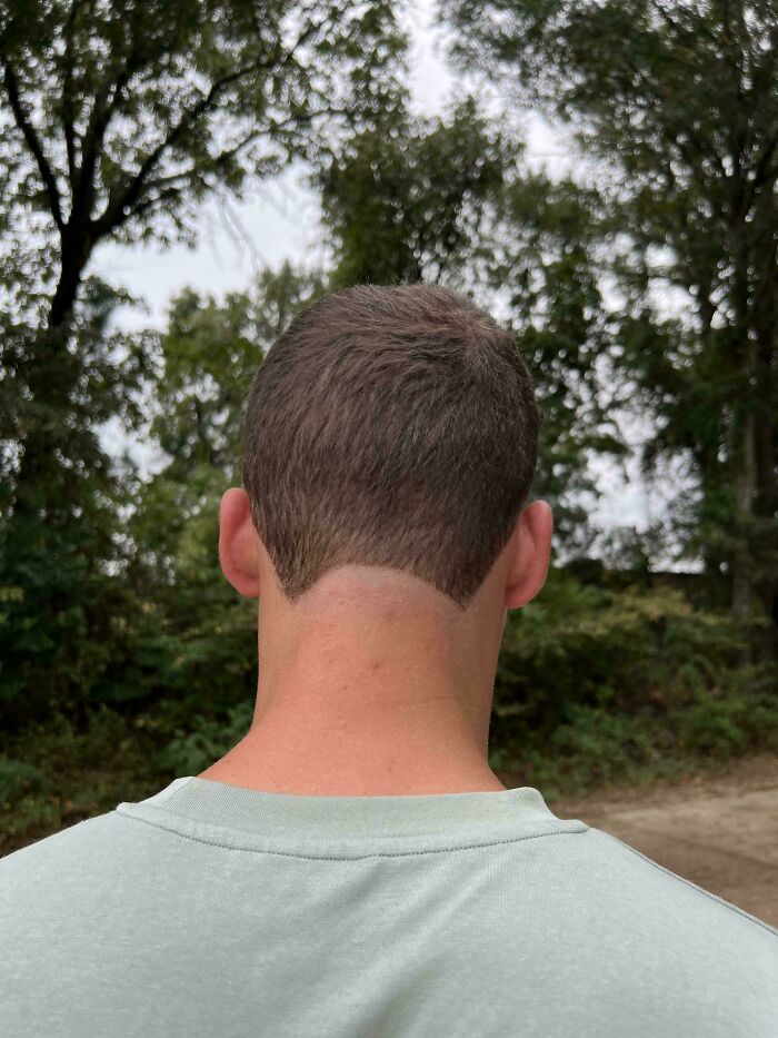 A person with a very poorly done fade haircut, showcasing a bad hair day.