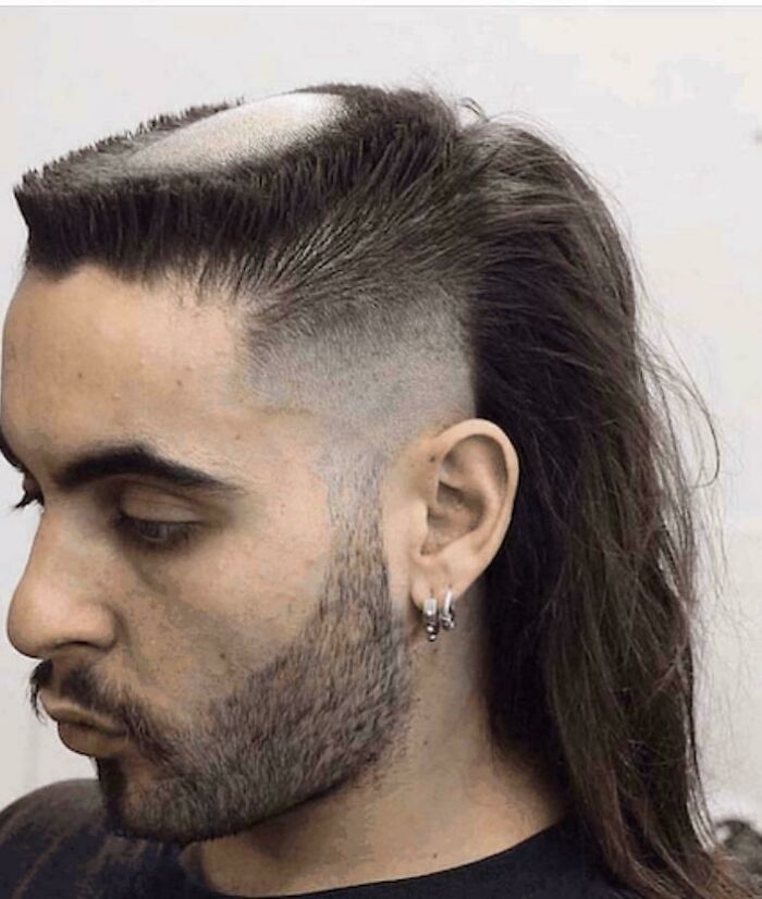 A man with a very unfortunate and viral bad hair day, featuring a poorly executed haircut.