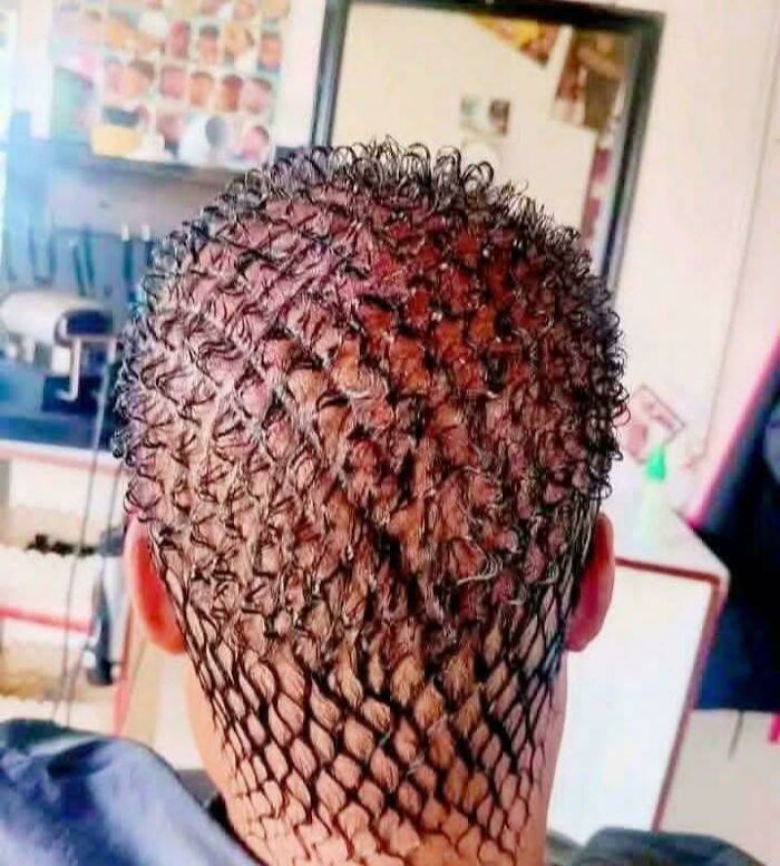 A person with an unusual bad hair day haircut, showing a mesh-like pattern on the back of their head.